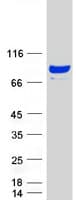 Human SHCBP1 Protein (Recombinant Myc-DDK (Flag))