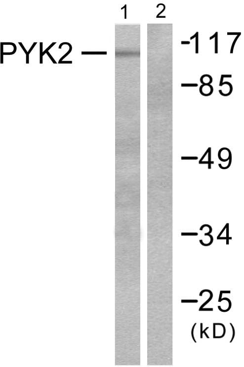 PTK2B / PYK2 Antibody (p881)