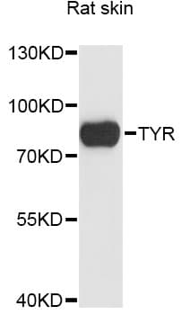 Tyrosinase Antibody