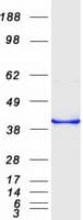 Human CDCA3 Protein (Recombinant Myc-DDK (Flag))
