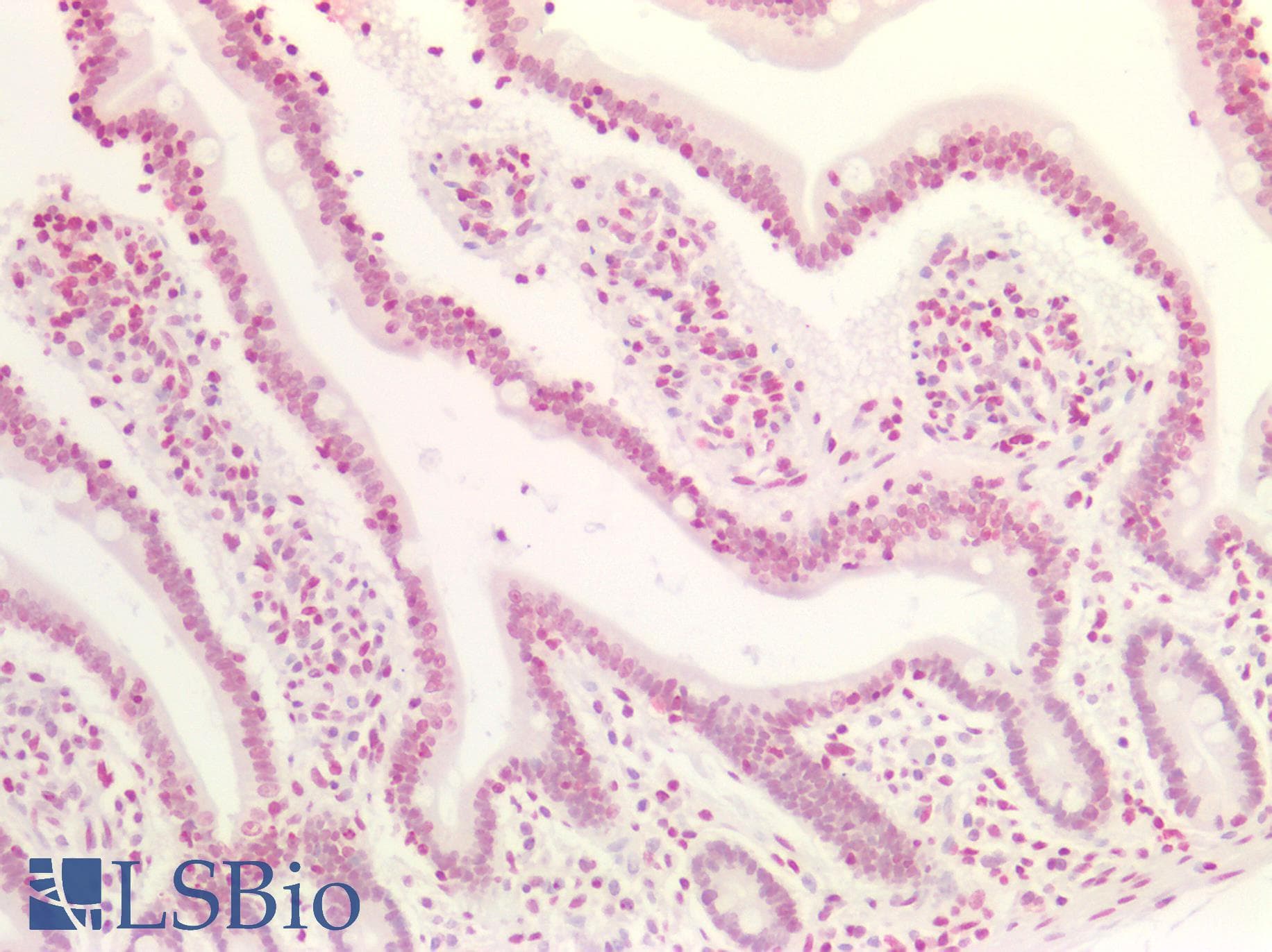 PathPlus™ MAX Antibody (aa147-160)