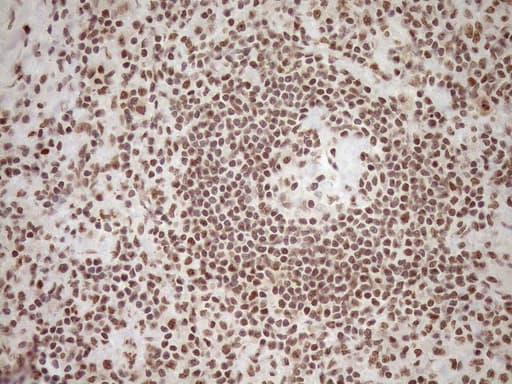 EXOSC1 / CSL4 Antibody (clone OTI1H9)