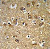 Polyclonal Rabbit anti-Human YIPF5 Antibody (aa21-49, IHC, WB)