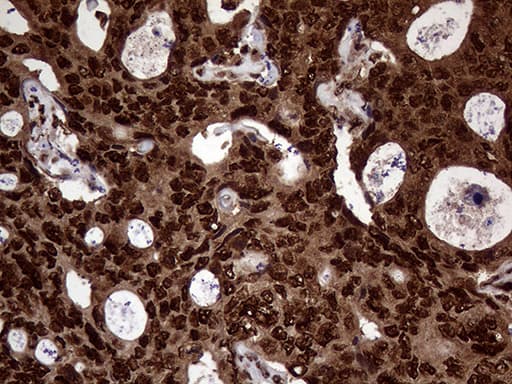TALDO1 / Transaldolase 1 Antibody (clone OTI2E4)
