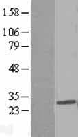 PDCD10 Protein (Over-Expression Lysate Myc-DDK (Flag))