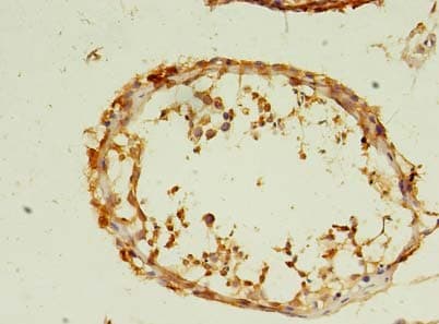 Polyclonal Rabbit anti-Human ACRV1/Intra-Acrosomal Protein Antibody (IHC)