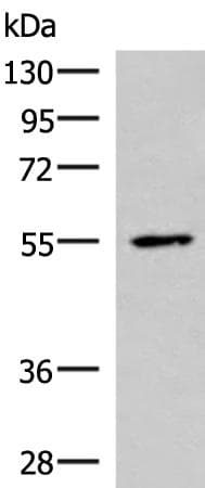 Polyclonal Rabbit anti-Human ISM1 Antibody (IHC, WB)