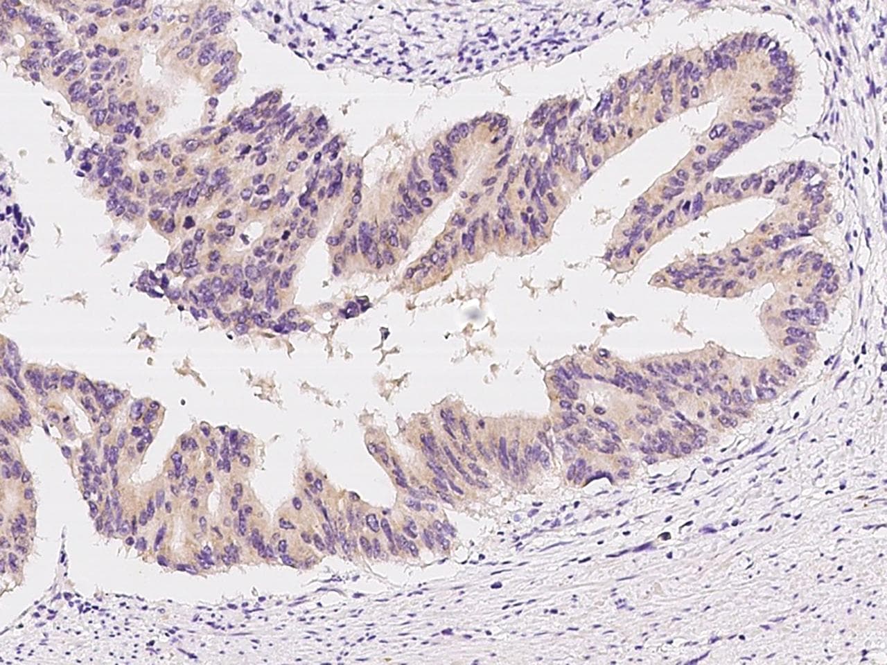 GH2 Antibody