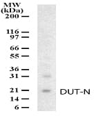 Polyclonal Rabbit anti-Human DUT / DUTPase Antibody (aa25-44, WB)