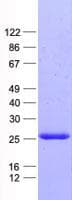 Human TIM23 Protein (Recombinant His, N-Terminal)