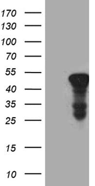 Monoclonal Mouse anti-Human ACAA1 Antibody (clone OTI4F1, IHC, WB)