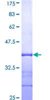 Human CXXC5 Protein (Recombinant GST, N-terminus)