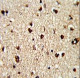 Polyclonal Rabbit anti-Human TECPR1 Antibody (aa1094-1122, IHC, WB)