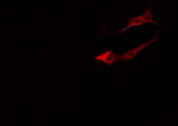 Polyclonal Rabbit anti-Human ARF4 Antibody (IF, WB)