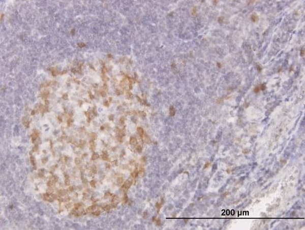 CDK1 / CDC2 Antibody (clone 8F1)