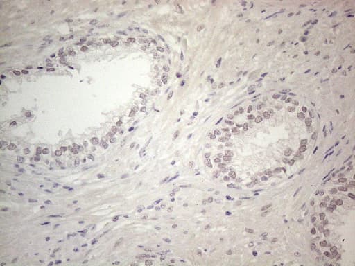 CSA / ERCC8 Antibody (clone OTI2G1, Carrier-free)