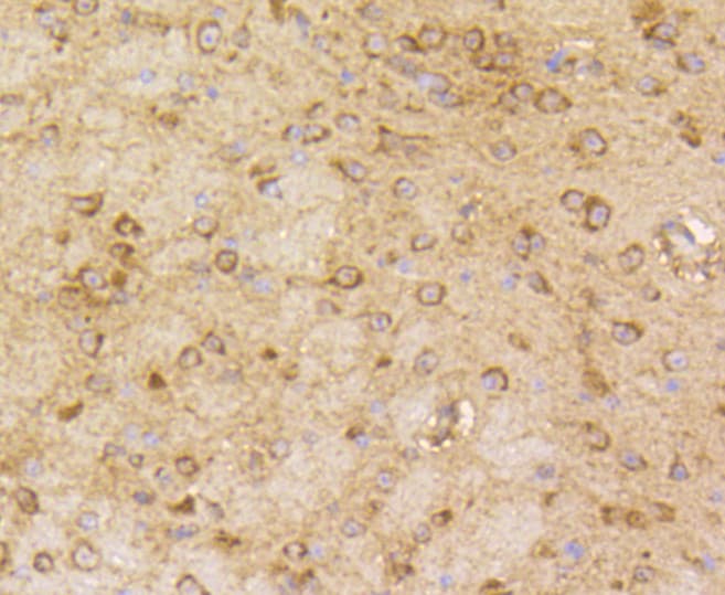 ARRB1 / Beta Arrestin 1 Antibody