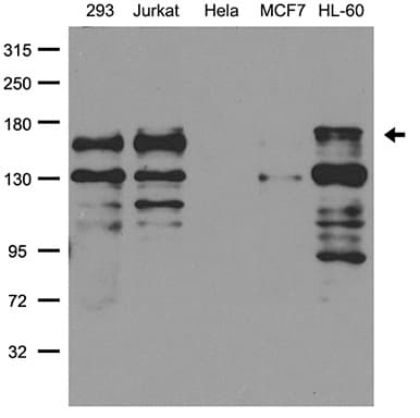 PALB2 Antibody
