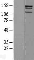 CENPJ / LAP Protein (Over-Expression Lysate Myc-DDK (Flag))