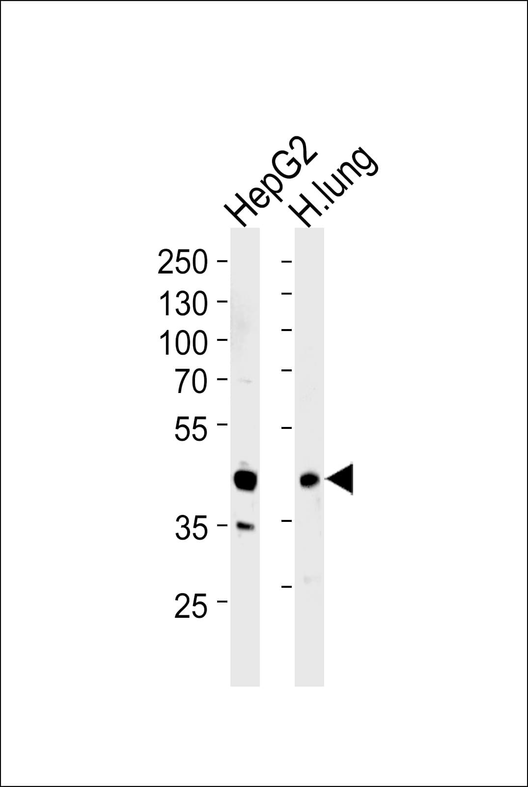 MOK / RAGE Antibody (aa206-234)