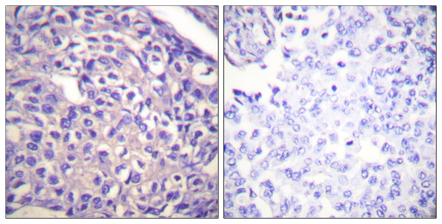 Polyclonal Rabbit anti-Human PPP1R12A / MYPT1 Antibody (aa661-710, IHC, WB)
