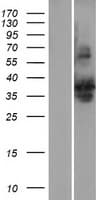 SLBP Protein (Over-Expression Lysate Myc-DDK (Flag))