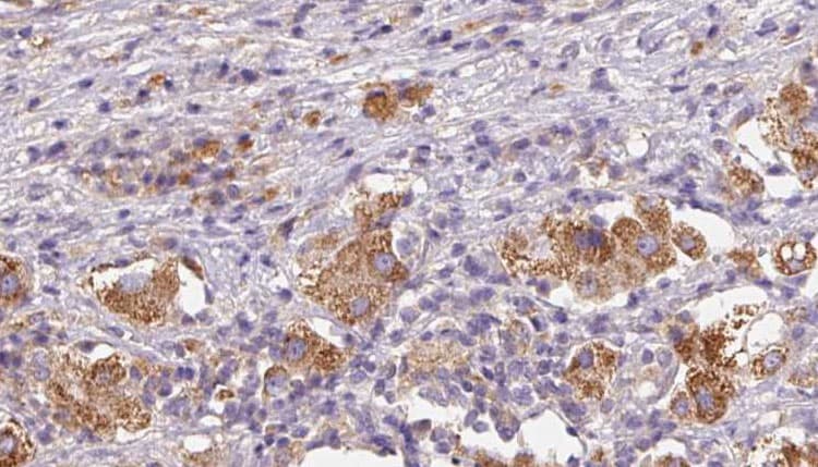 IL31RA Antibody