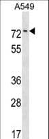 Polyclonal Rabbit anti-Human HKR1 Antibody (aa133-159, WB)