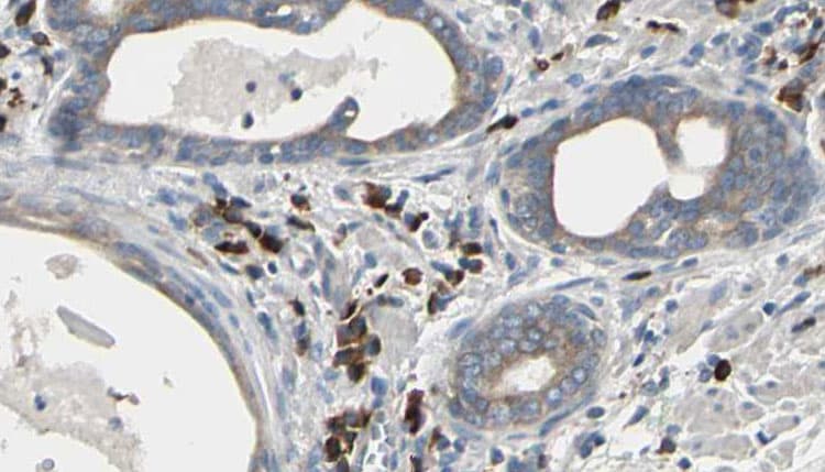 Polyclonal Rabbit anti-Human US01 / p115 Antibody (IHC, IF, WB)