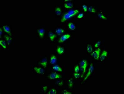 Polyclonal Rabbit anti-Human SNAP23 / SNAP-23 Antibody (IHC)