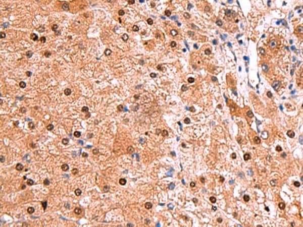 Polyclonal Rabbit anti-Human TSEN2 Antibody (IHC, WB)