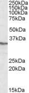 IHC-plus™ PPP4C Antibody (aa290-301)