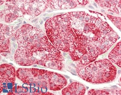 Polyclonal Rabbit anti-Mouse LINGO2 Antibody (C-Terminus, IHC, WB)