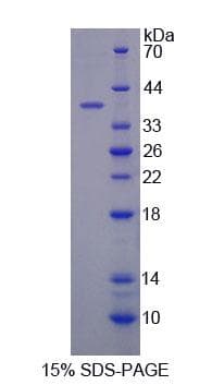 Human COX6C Protein (Recombinant His-GST, N-terminus)