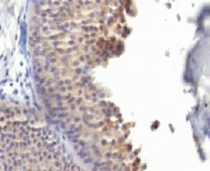 KRT10 / CK10 / Cytokeratin 10 Antibody (clone KRT10/1275, Ready-to-Use)