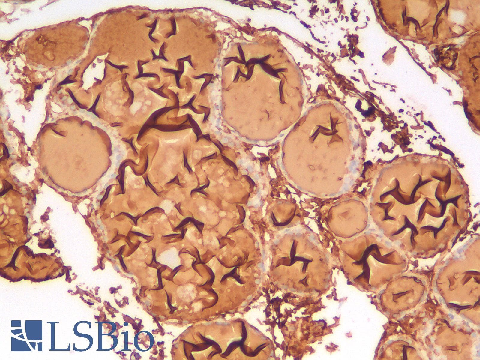 PathPlus™ TG / Thyroglobulin Antibody (clone TGB/1968R)
