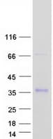 Human IGFBP7 / TAF Protein (Recombinant Myc-DDK (Flag))
