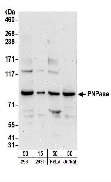PNPT1 Antibody (aa700-750)