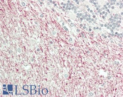 IHC-plus™ SCNN1D Antibody (aa397-446)