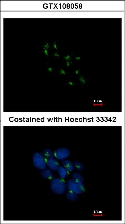 Polyclonal Rabbit anti-Human VPS35 Antibody (aa733-796, IHC, WB)