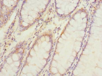 ATP6V0A4 Antibody