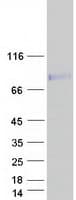 Human CCDC85A Protein (Recombinant Myc-DDK (Flag))