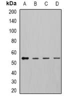 DLD / Diaphorase / E3 Antibody