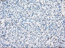PPP5C Antibody (clone OTI6C2)