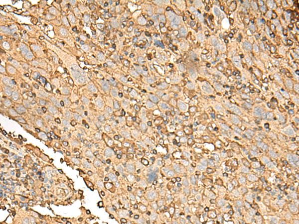 UBE2A Antibody