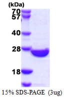 Human SENP8 Protein (Recombinant His)
