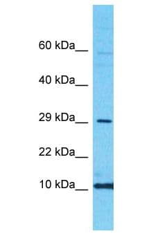 Polyclonal Rabbit anti-Human CRABP2 Antibody (aa81-130, WB)