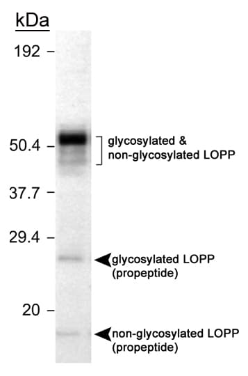LOX / Lysyl Oxidase Antibody (aa78-115)