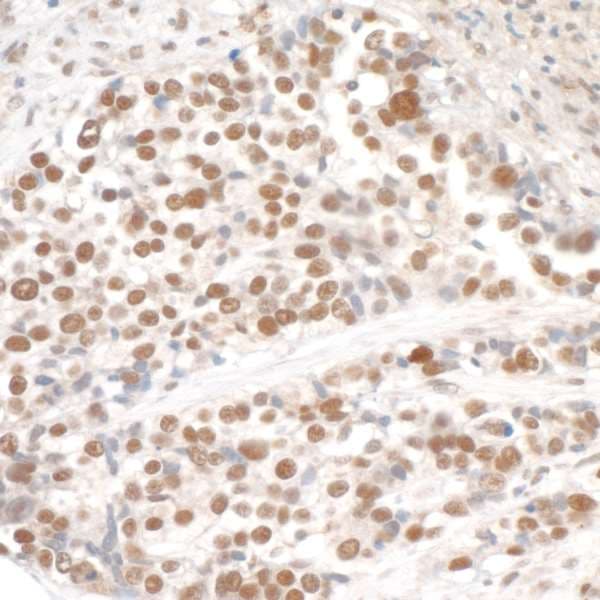 SMC3 / HCAP Antibody (aa1175-C-term)