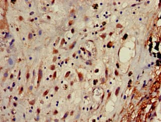 AP1G1 / Adaptin Gamma 1 Antibody